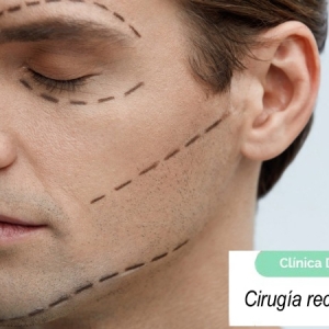 Imagen Cirugía reconstructiva facial